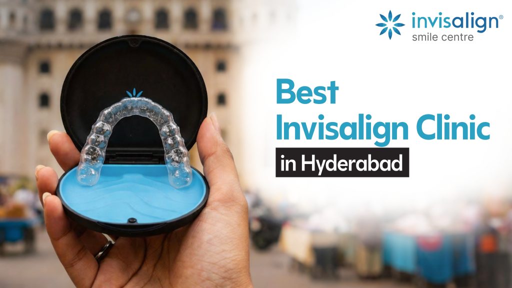best invisalign clinic in hyderabad