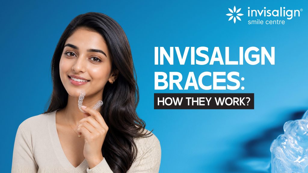 invisible braces